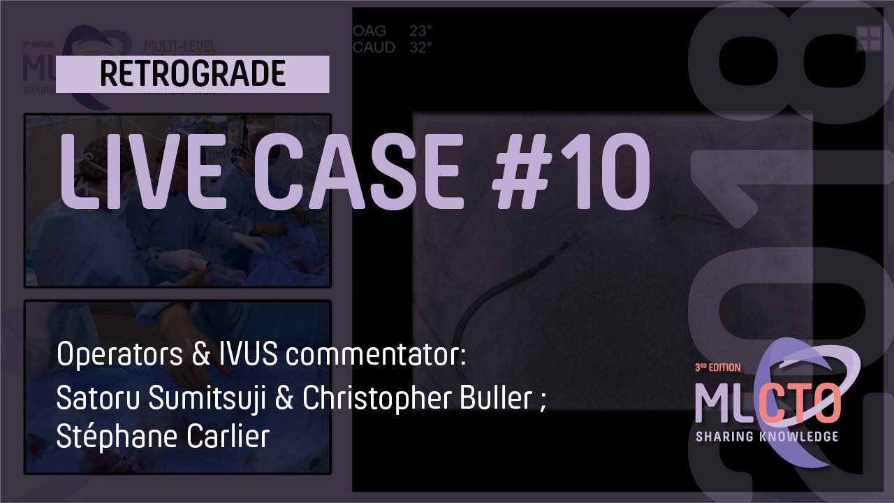 LIVE CASE #10