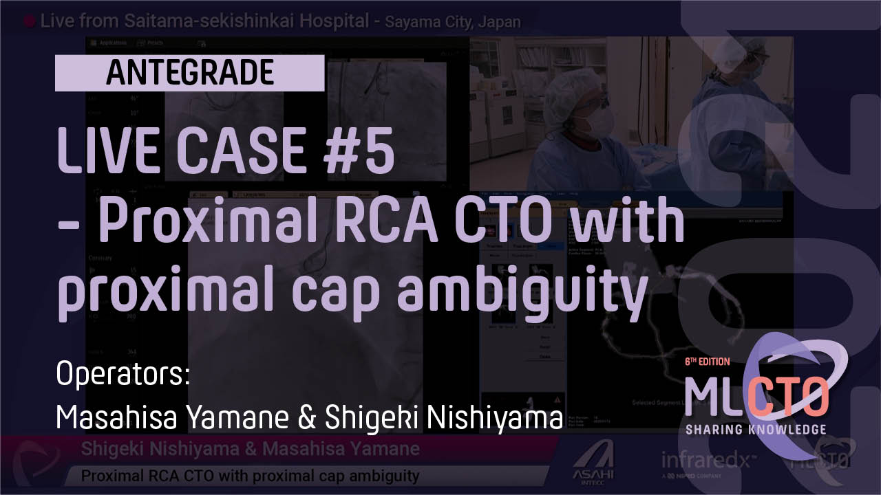 Proximal RCA CTO with proximal cap ambiguity