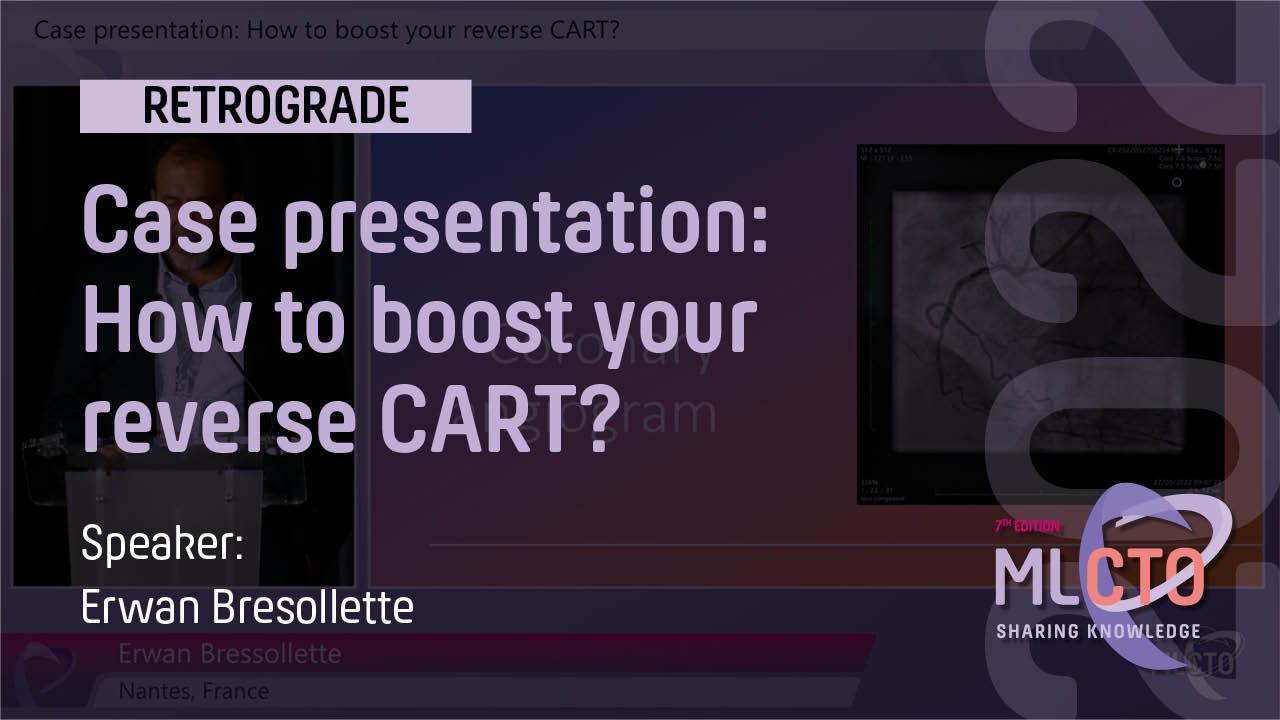 Case presentation: How to boost your reverse CART?