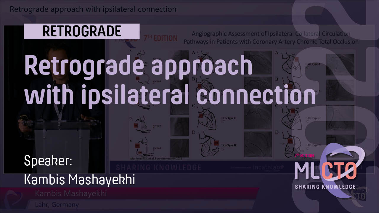 Retrograde approach with ipsilateral connection