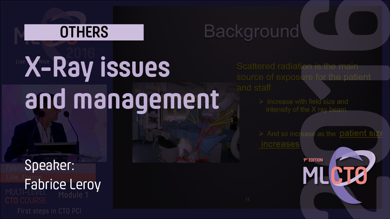 X-Ray issues and management