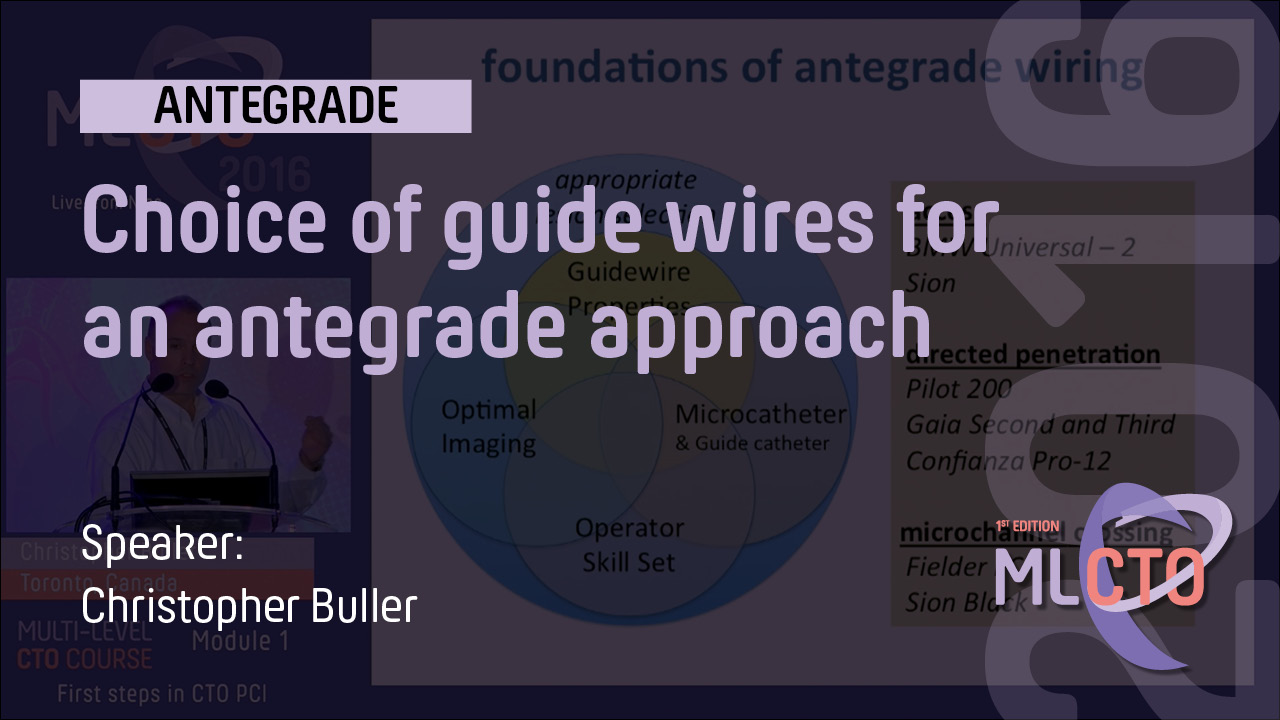 Choice of guide wires for an antegrade approach