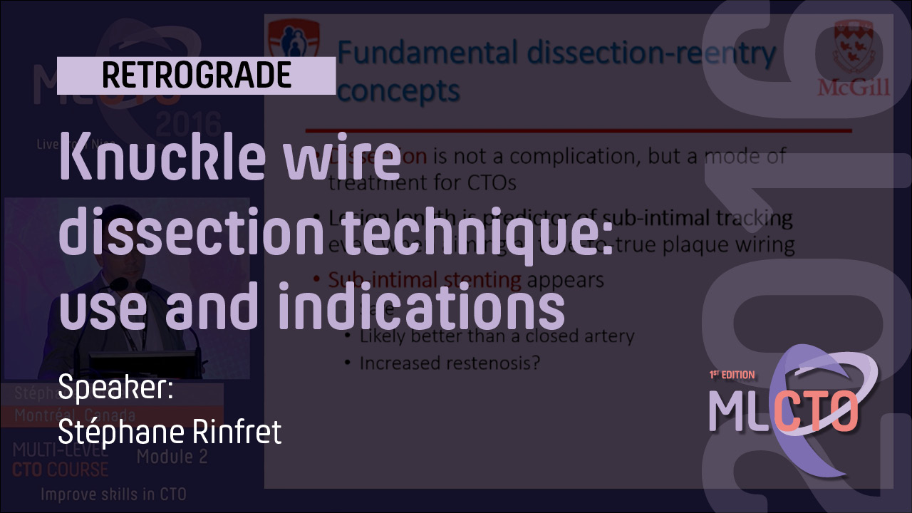 Knuckle wire dissection technique: use and indications