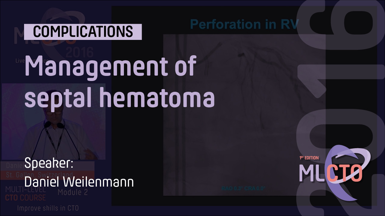 Management of septal hematoma