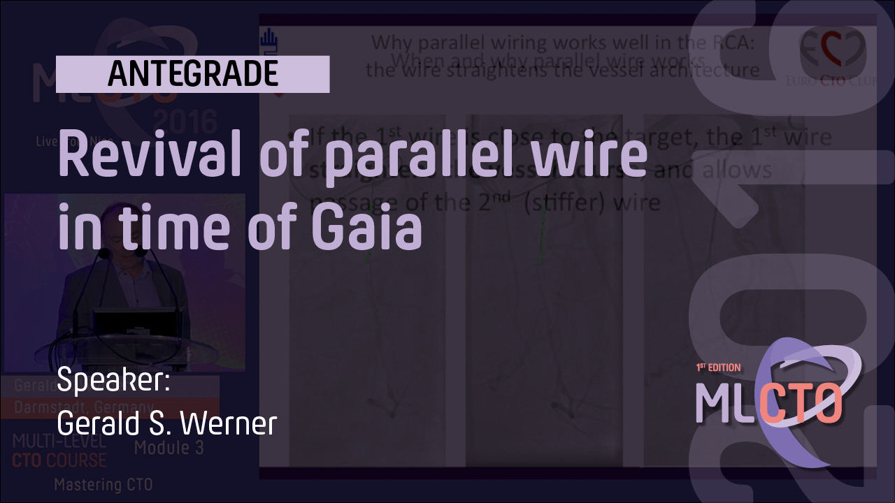 Revival of parallel wire in time of Gaia