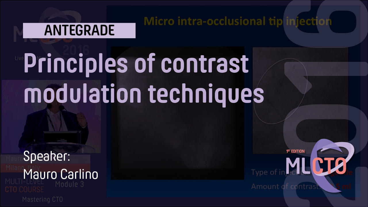 Principles of contrast modulation techniques