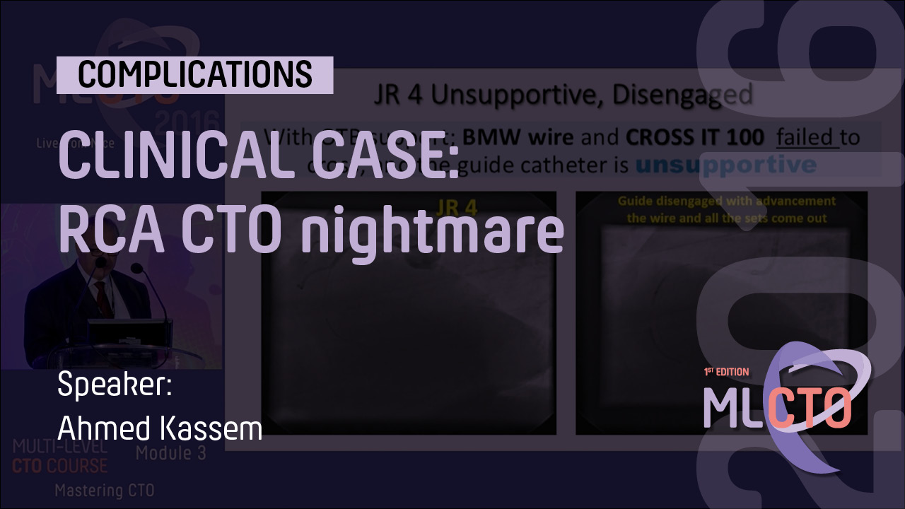 CLINICAL CASE: RCA CTO nightmare