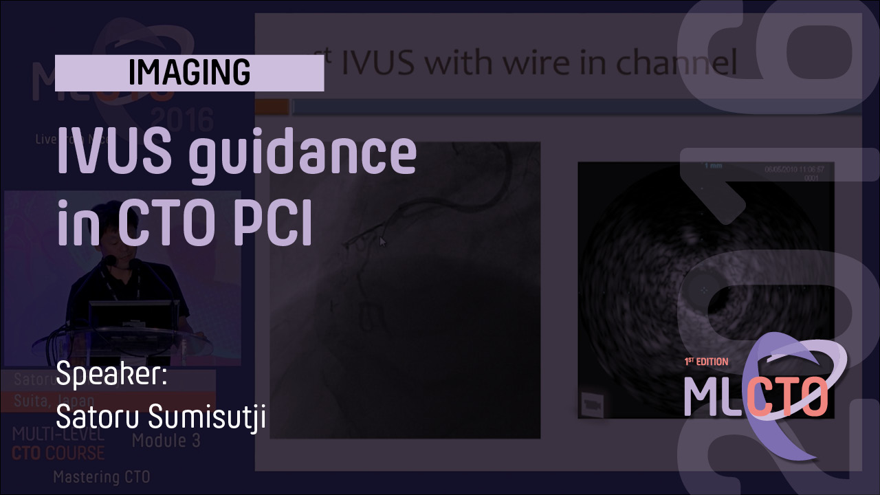 IVUS guidance in CTO PCI