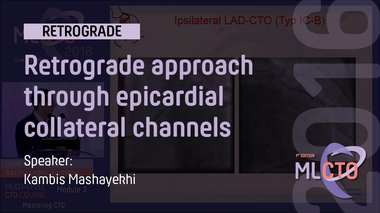 Retrograde approach through epicardial collateral channels