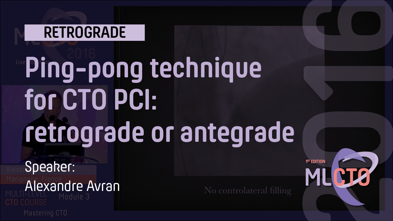 Ping-pong technique for CTO PCI: retrograde or antegrade