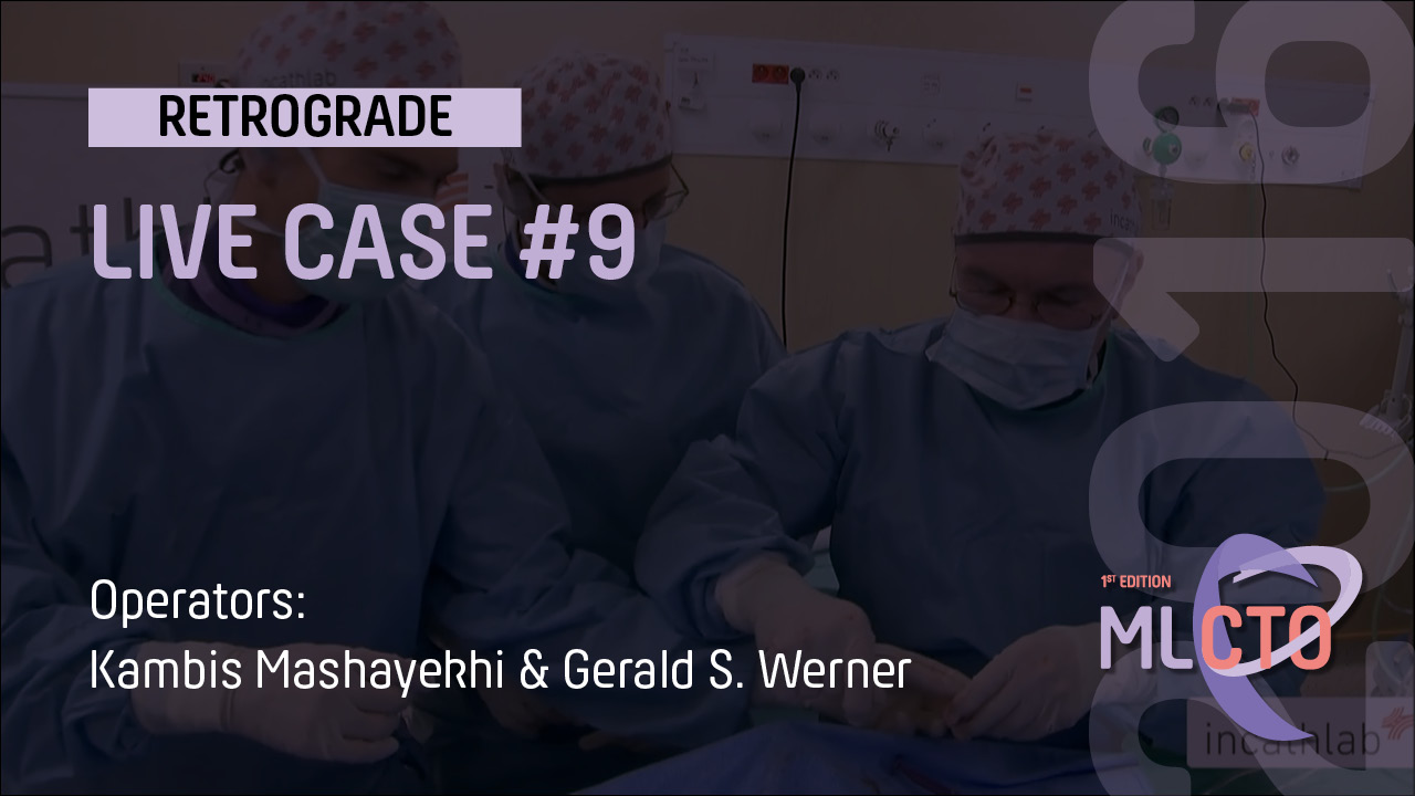 LIVE CASE #9 / ML CTO 2016