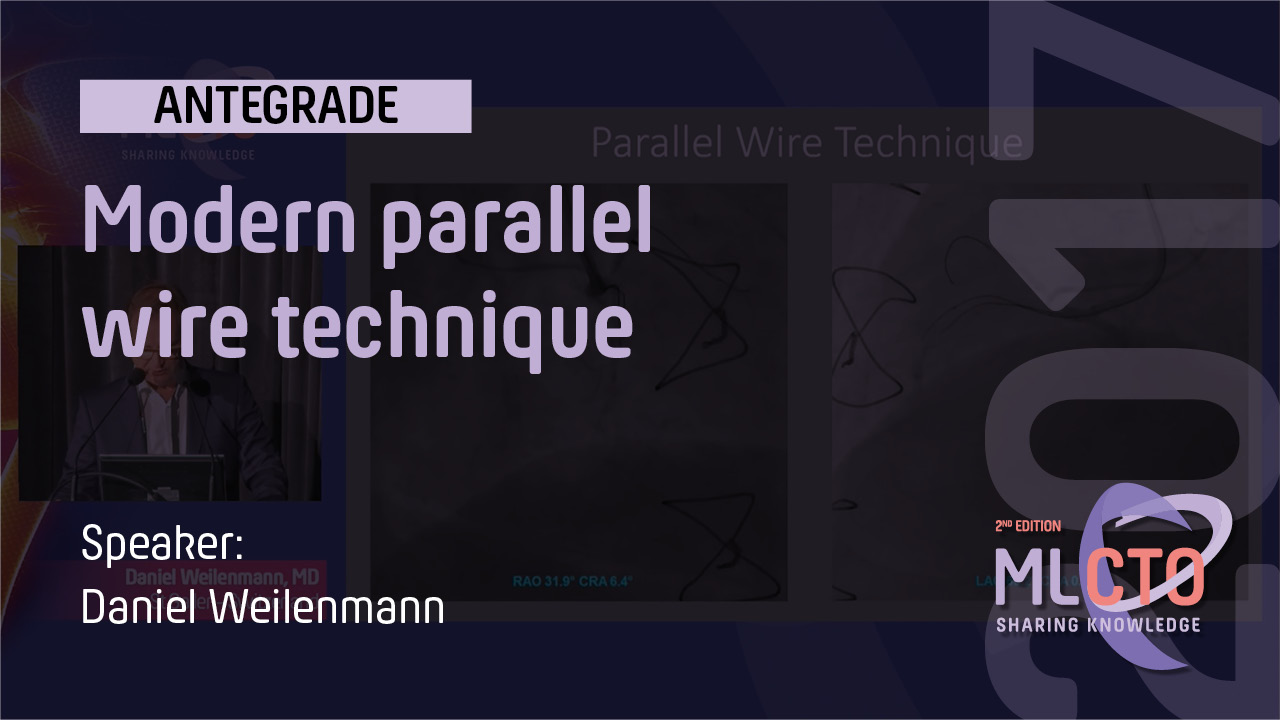 Modern parallel wire technique