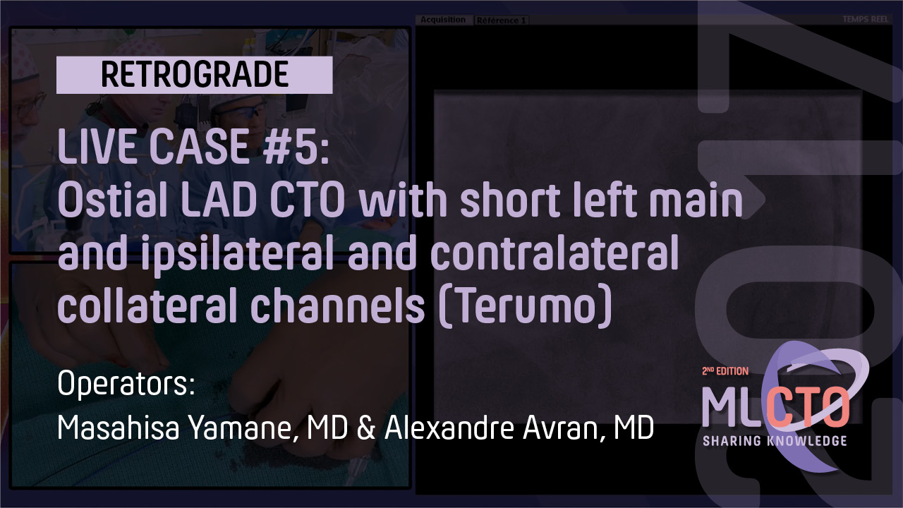 LIVE CASE #5 / ML CTO 2017