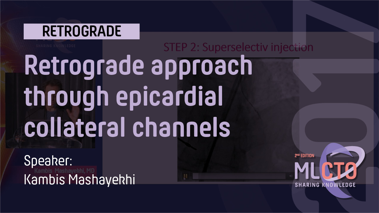 Retrograde approach through epicardial collateral channels