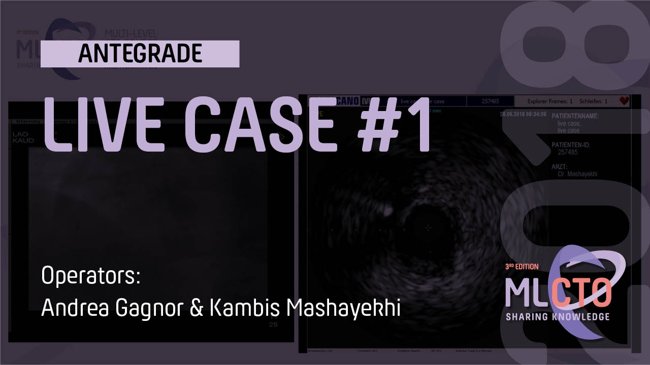 LIVE CASE #1