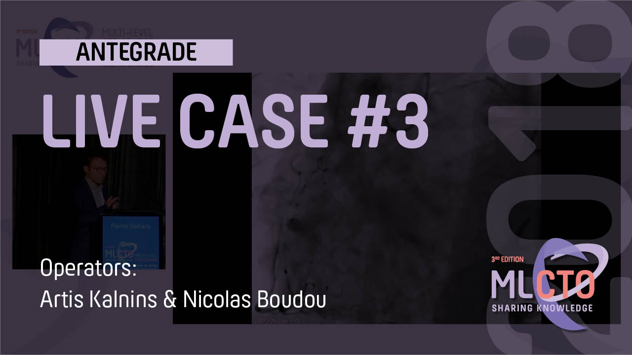 LIVE CASE #3