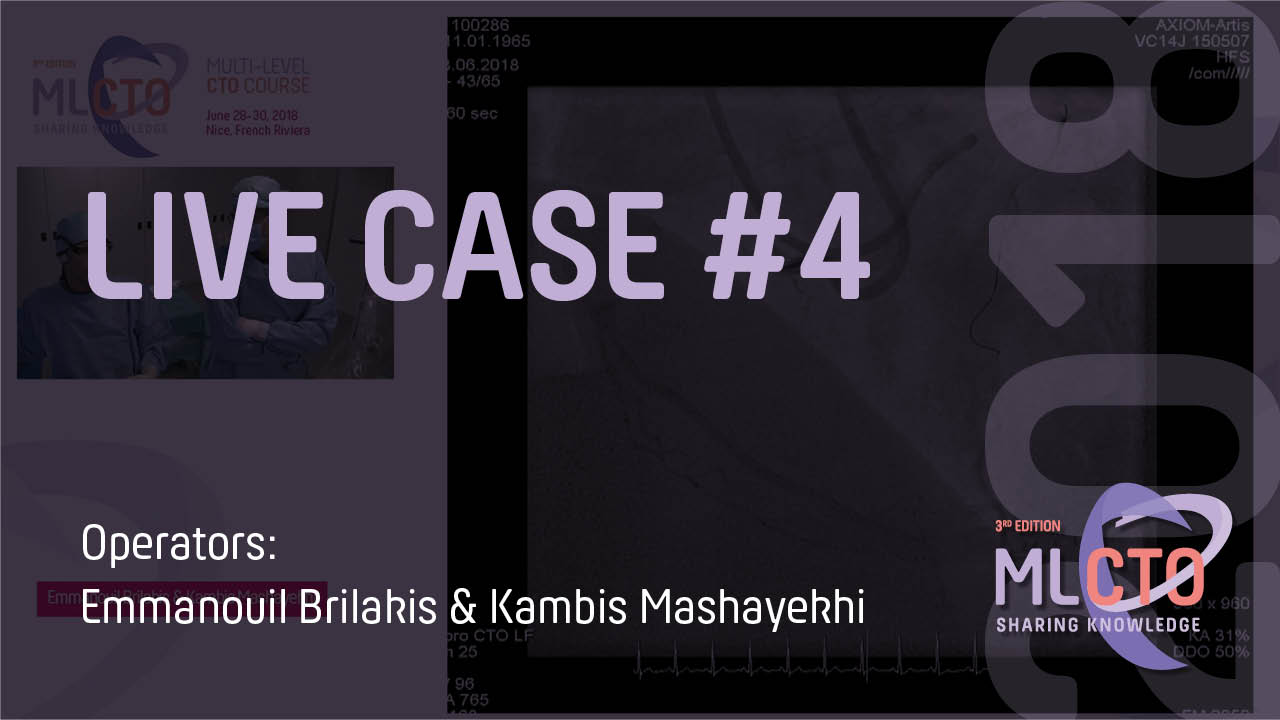 LIVE CASE #4