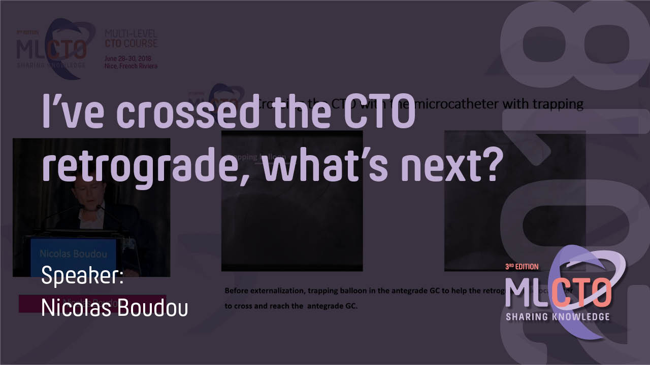 I’ve crossed the CTO retrograde, what’s next?