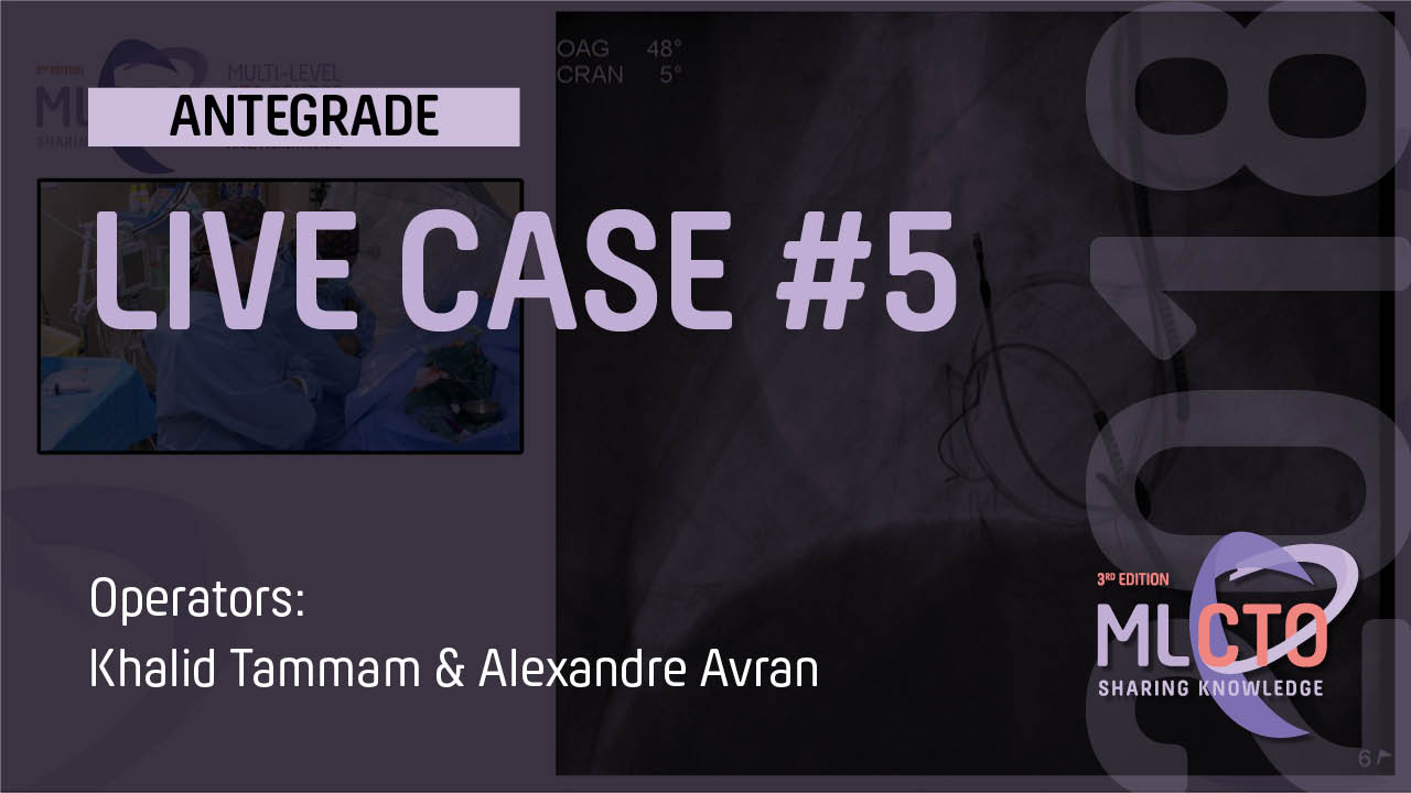 LIVE CASE #5