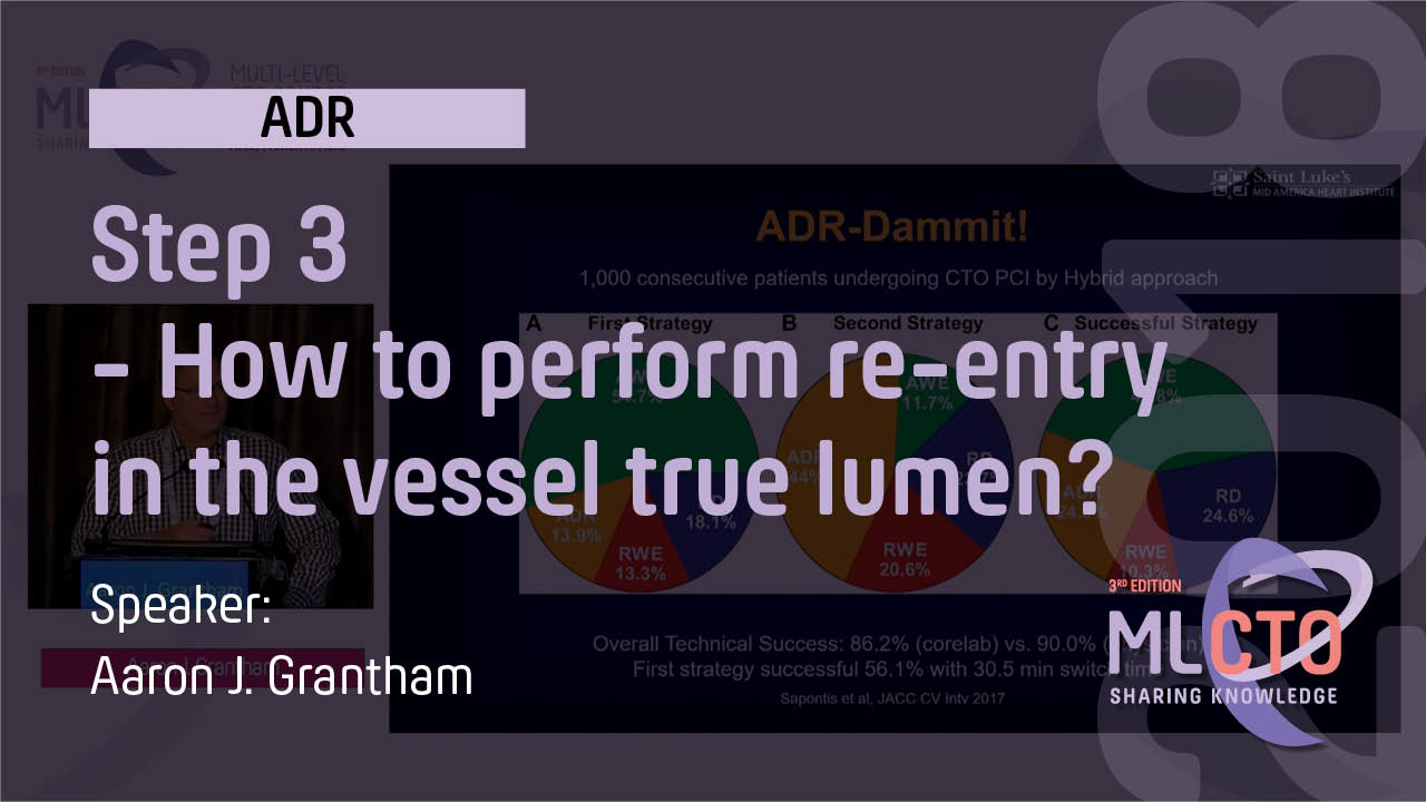 Step 3 – How to perform re-entry in the vessel true lumen?