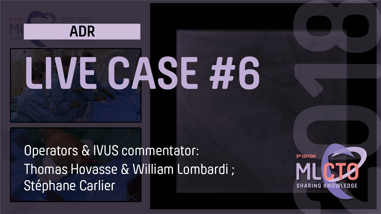 LIVE CASE #6