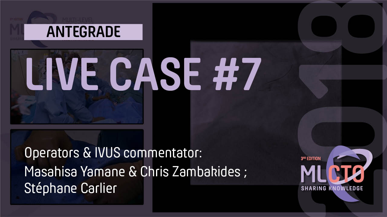 LIVE CASE #7