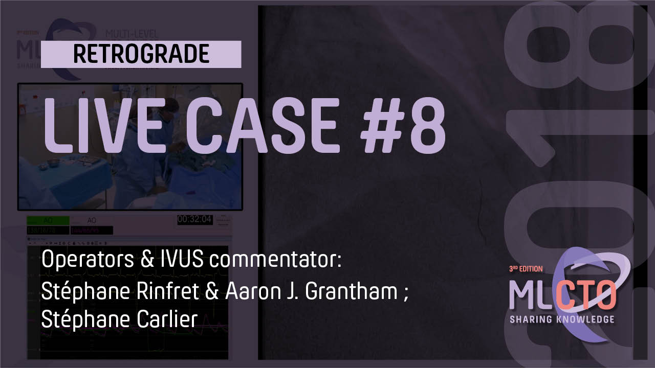 LIVE CASE #8