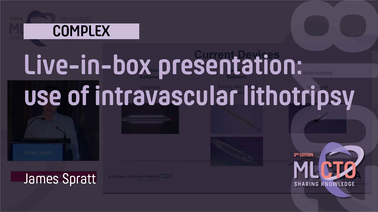 Live-in-box presentation: use of intravascular lithotripsy