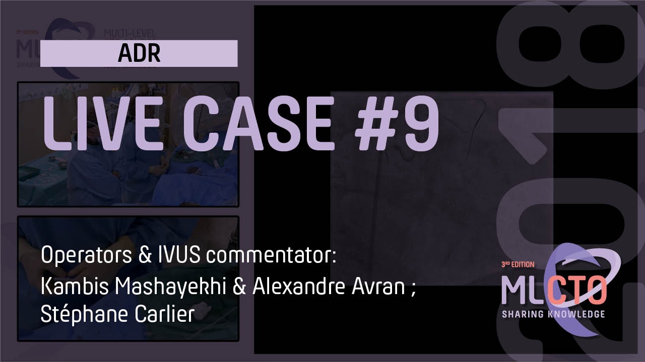 LIVE CASE #9