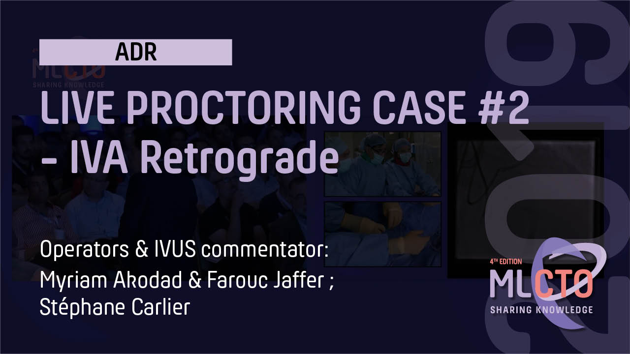 LIVE CASE #2 / ML CTO 2019