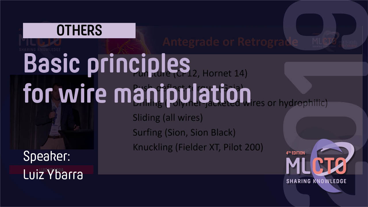 Basic principles for wire manipulation