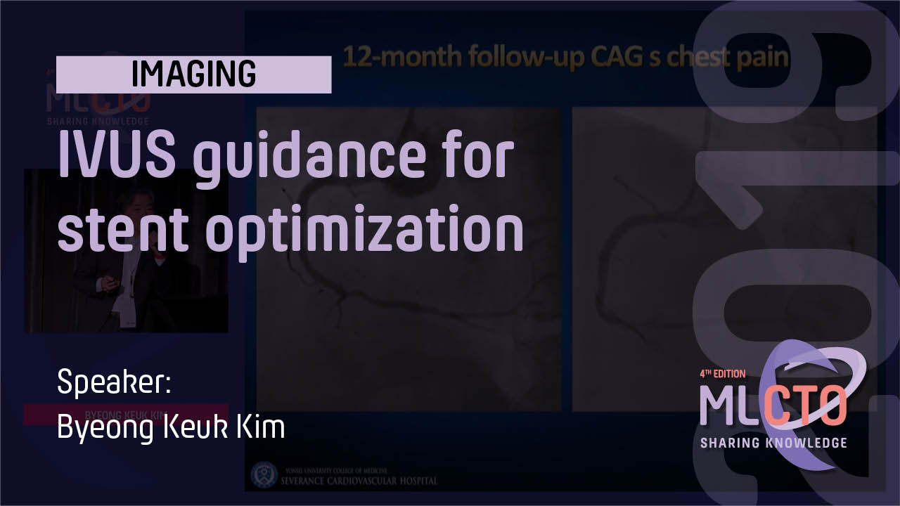 IVUS guidance for stent optimization