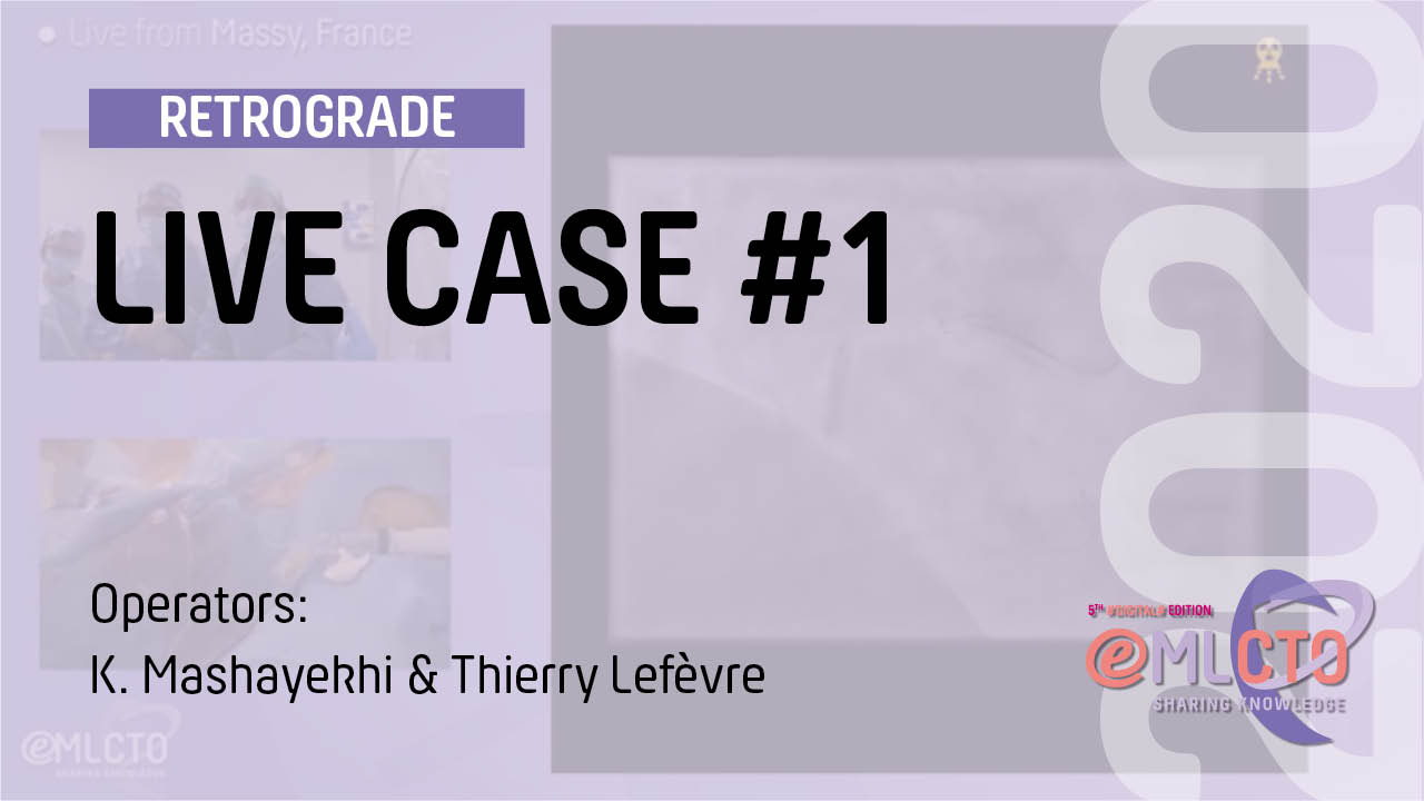 LIVE CASE #1 / ML CTO 2020