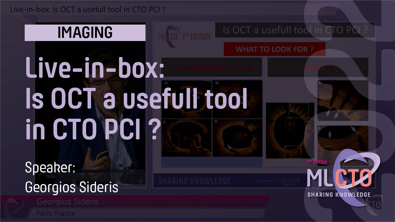 Live-in-box: Is OCT a usefull tool in CTO PCI ?