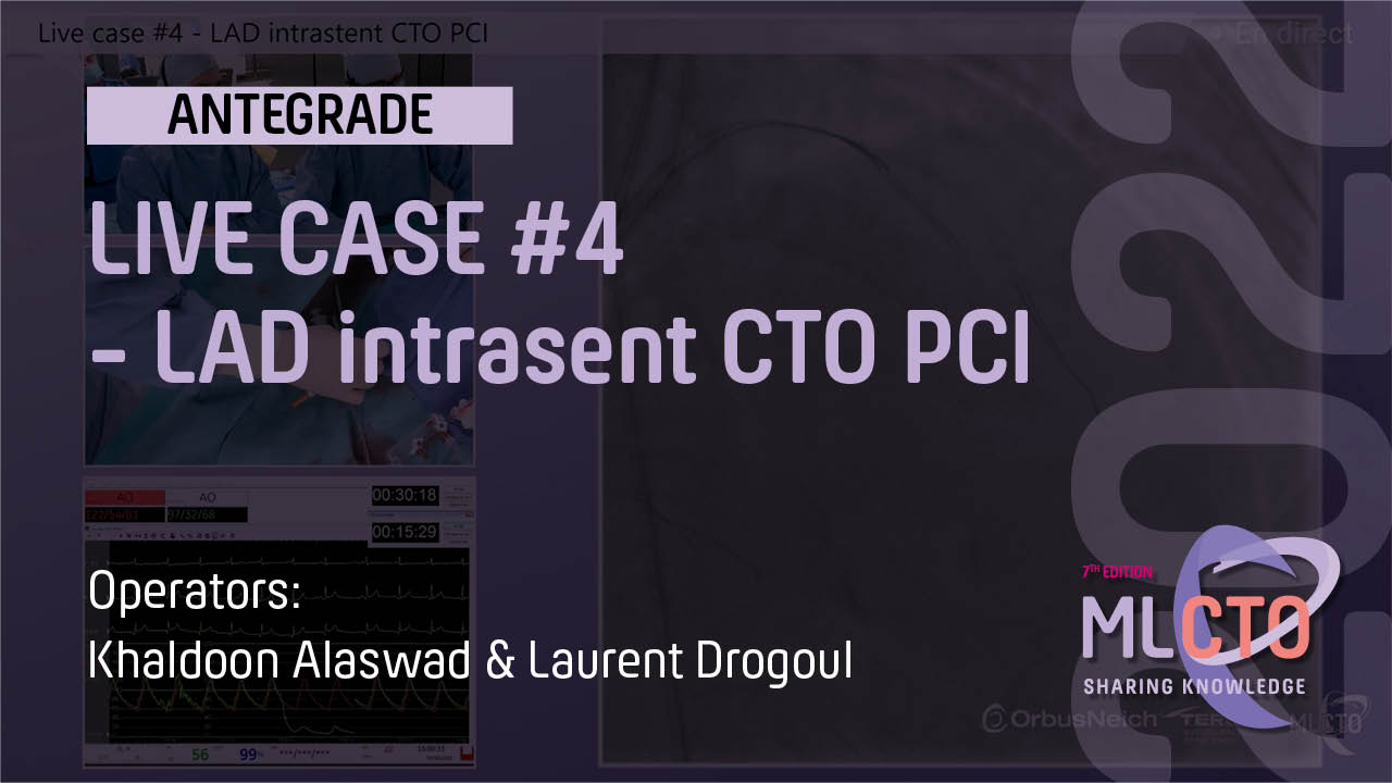 LIVE CASE #4 / ML CTO 2022