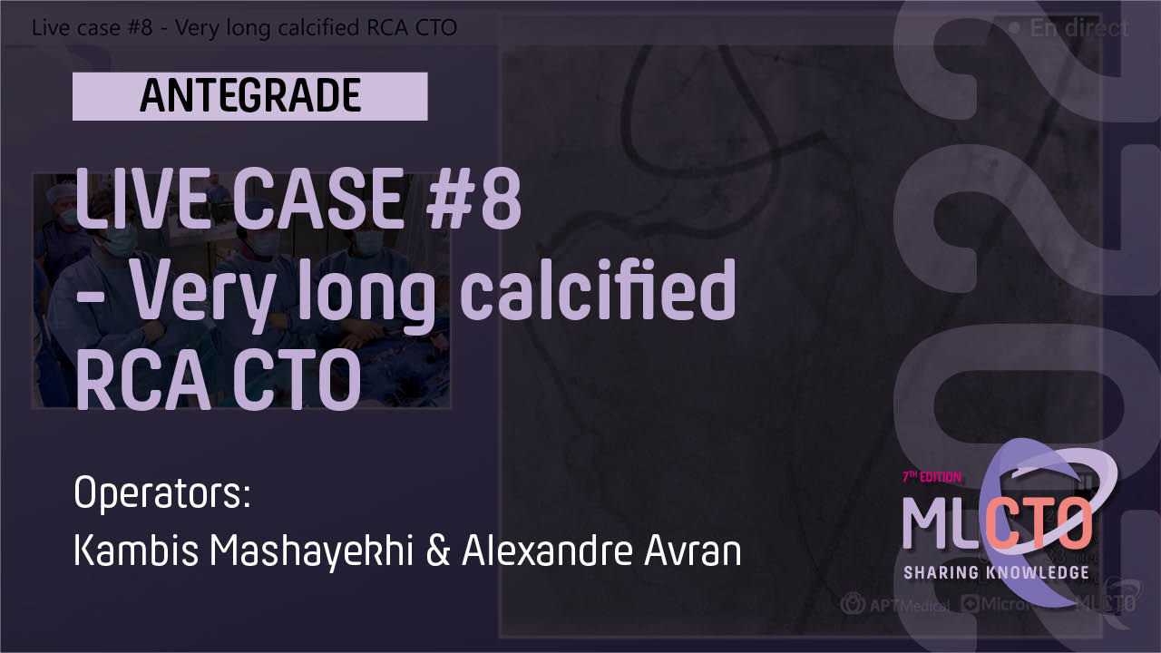 LIVE CASE #8 / ML CTO 2022