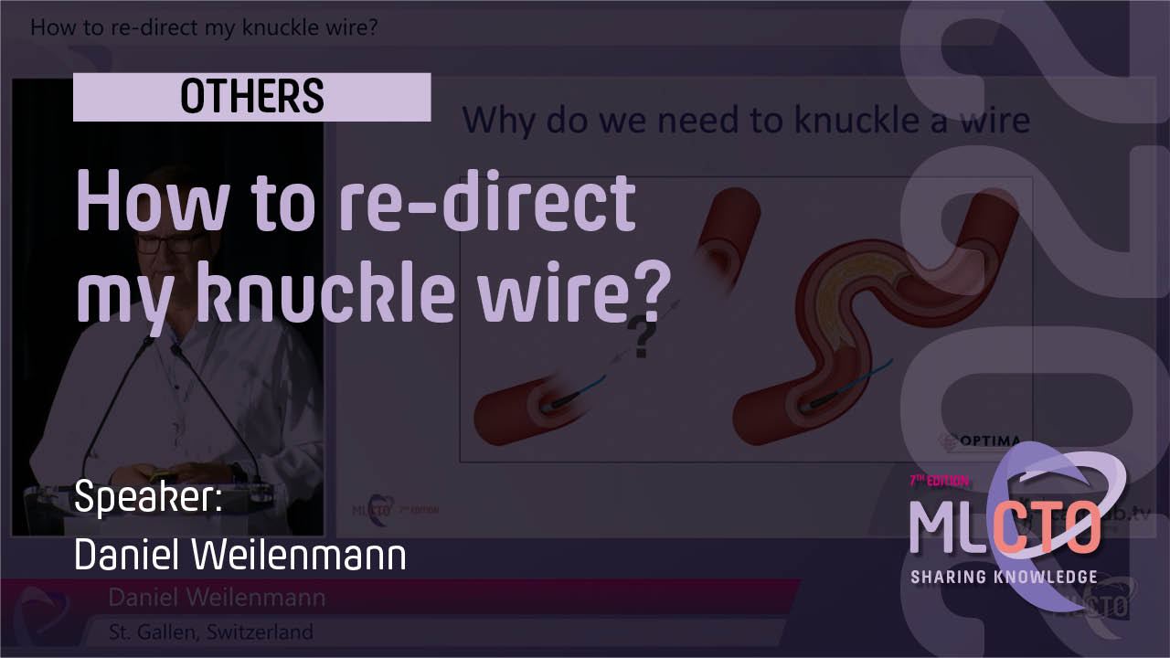 How to re-direct my knuckle wire?