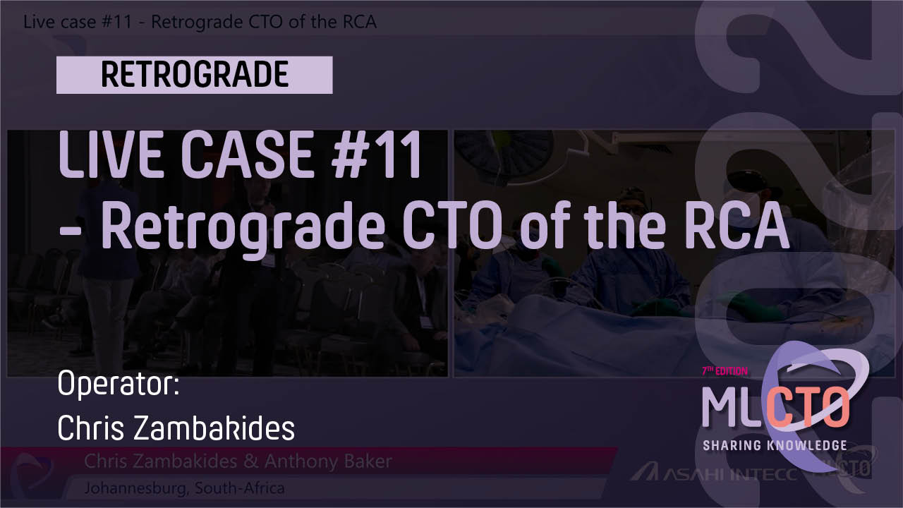 LIVE CASE #11 / ML CTO 2022