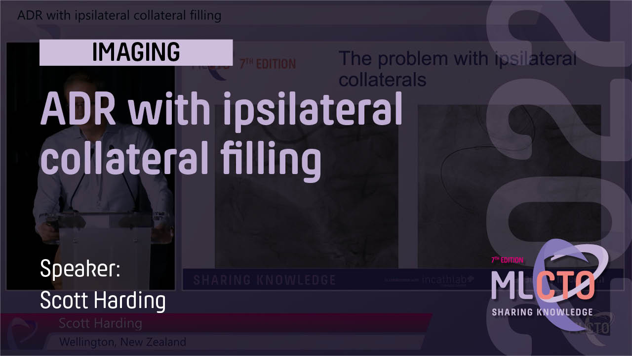 ADR with ipsilateral collateral filling