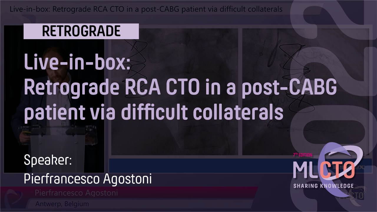 Live in box Retrograde RCA CTO in a post CABG patient via difficult collaterals