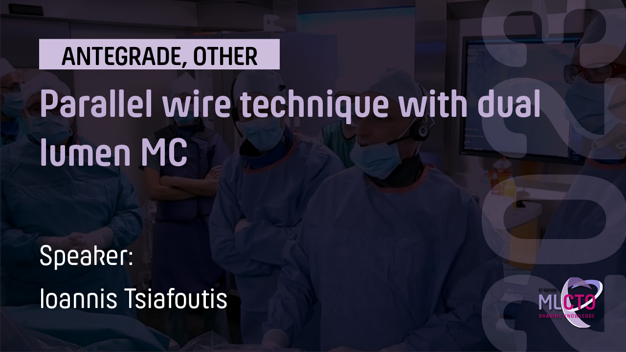 Parallel wire technique with dual lumen MC