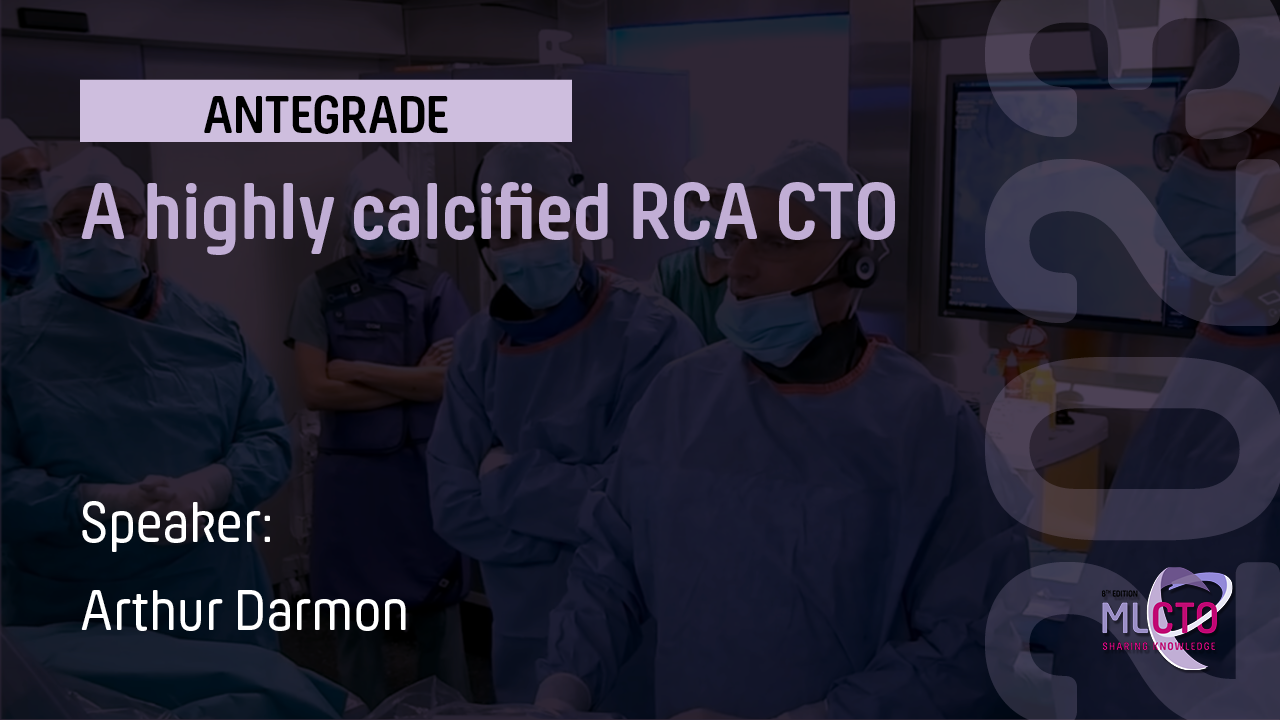 A highly calcified RCA CTO