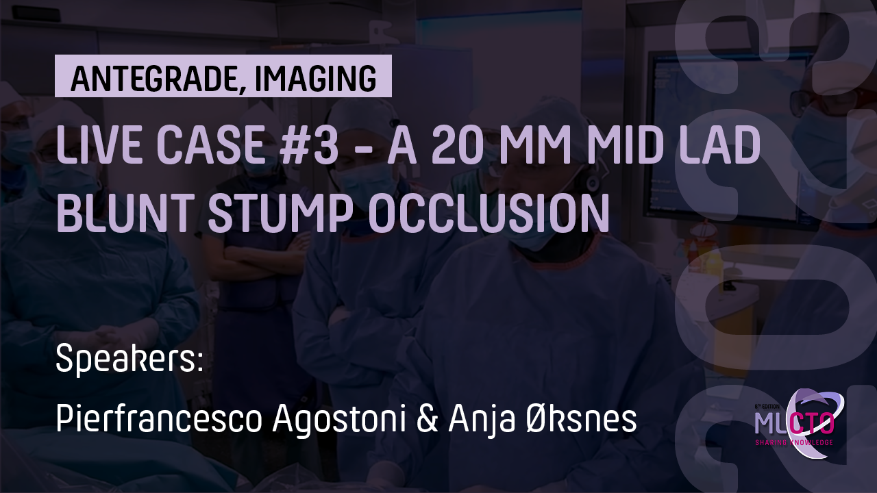 LIVE CASE #3 – A 20 MM MID LAD BLUNT STUMP OCCLUSION