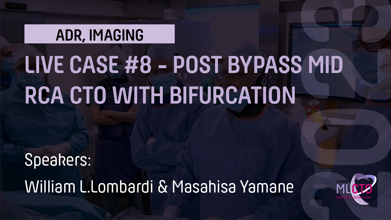 LIVE CASE #8 – POST BYPASS MID RCA CTO WITH BIFURCATION
 AT THE DISTAL CAP