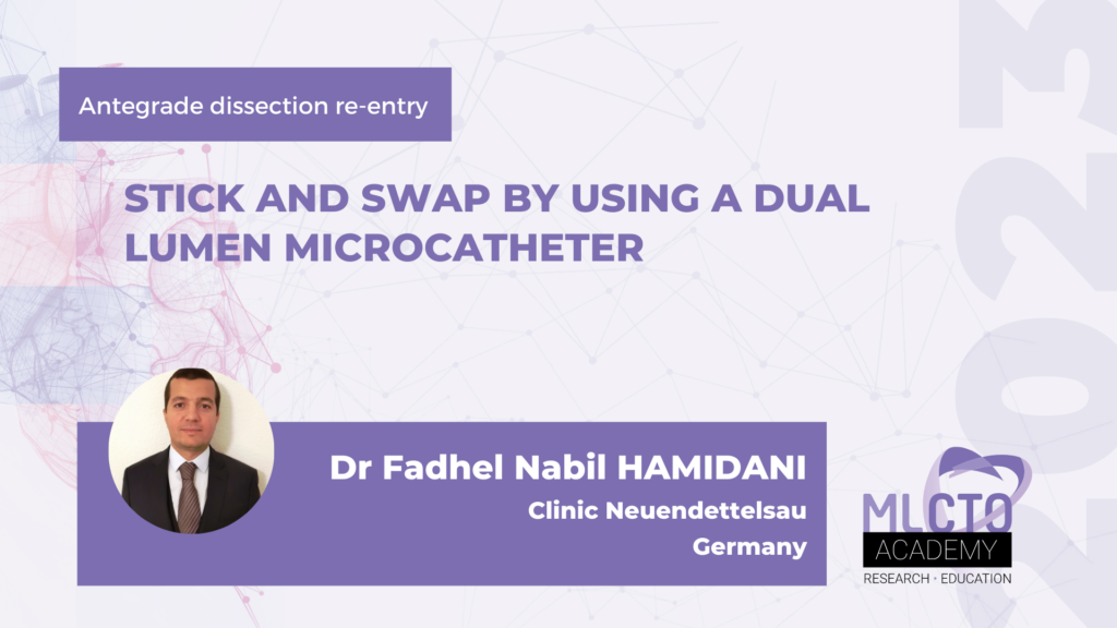 Stick and swap by using a dual lumen microcatheter