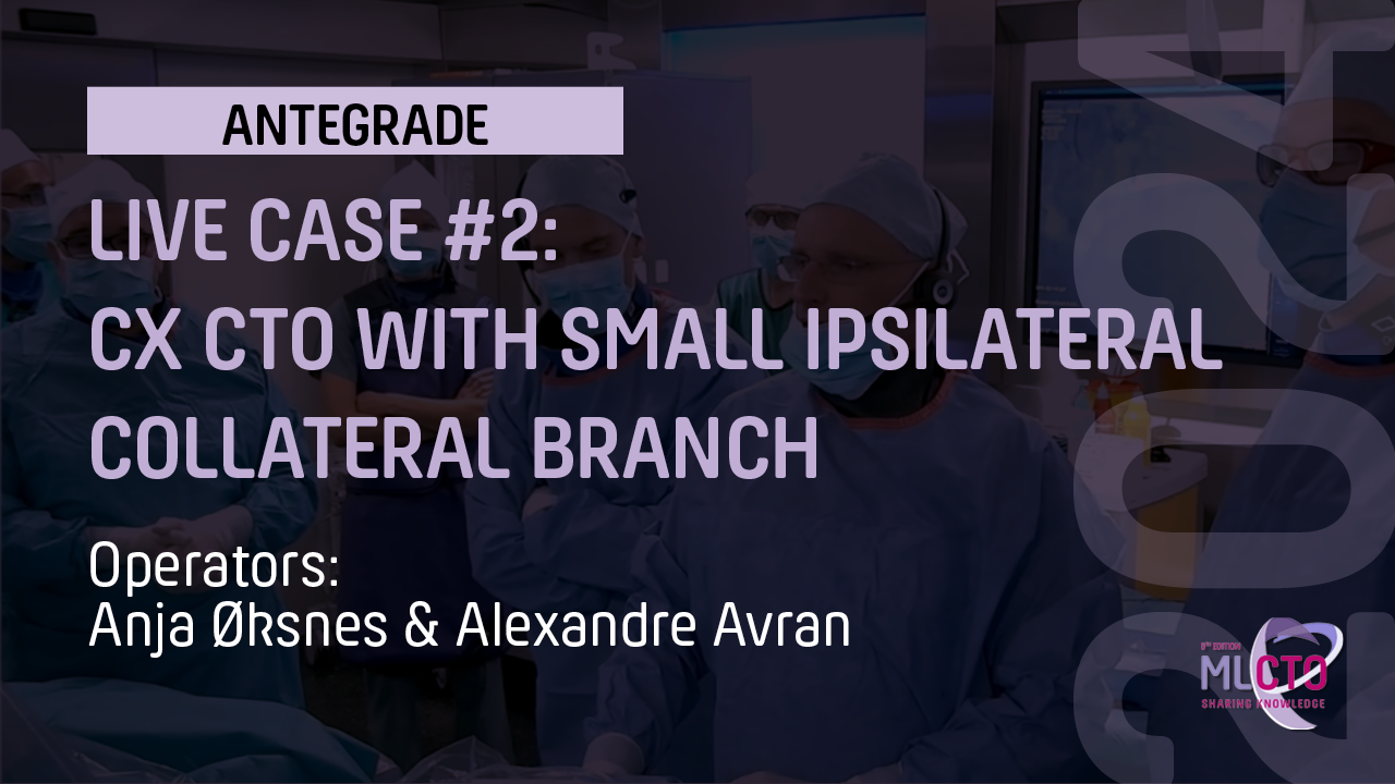 The art of connecting antegrade from the SI space