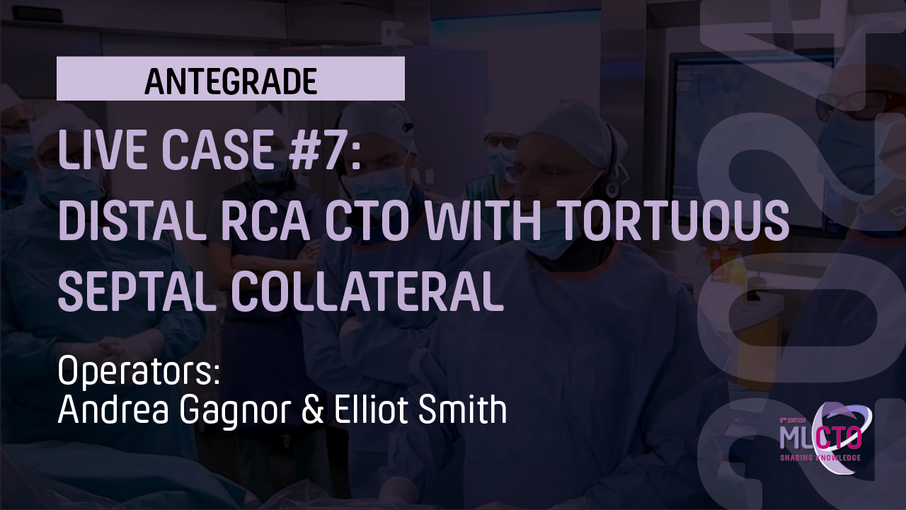 Proximal CTO RCA – Not what I expected