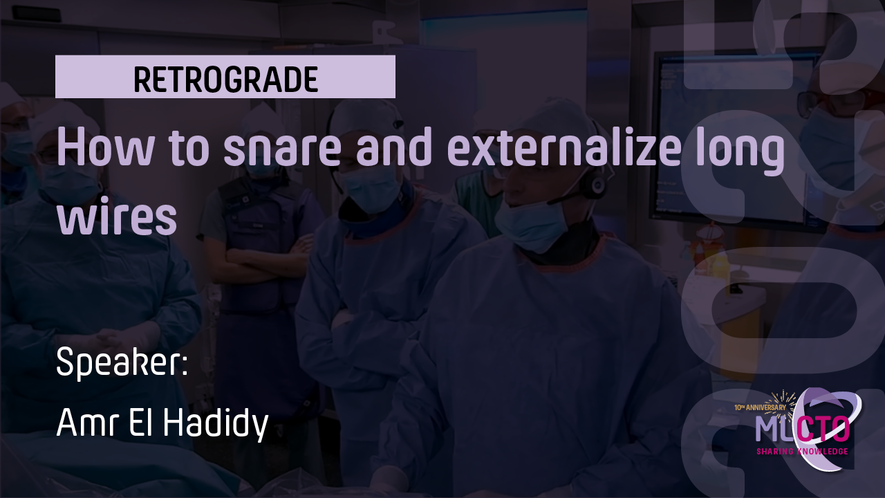 How to snare and externalize long wires