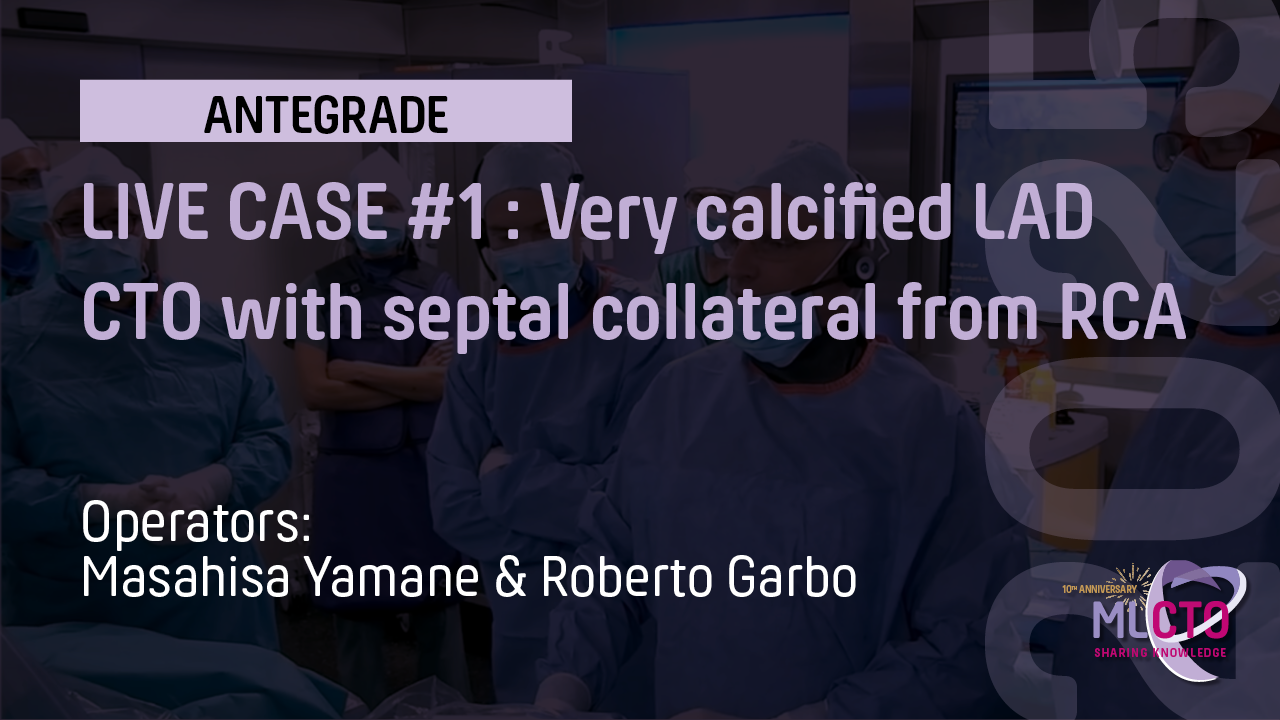 LIVE CASE #1 : Very calcified LAD CTO with septal collateral from RCA
