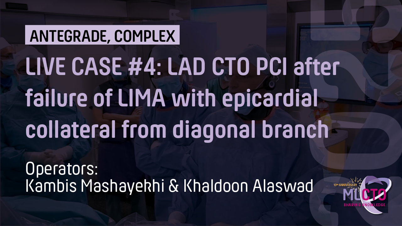 LIVE CASE #4 : LAD CTO PCI after failure of LIMA with epicardial collateral from diagonal branch